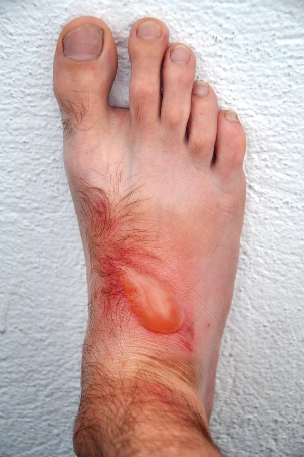 Comment diagnostiquer et traiter les dermatites chez un chat de race American Curl?